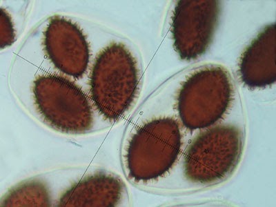 Tuber melanosporum spores Tuber melanosporum spores