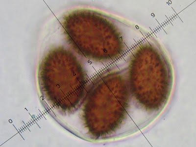 Tuber-melanosporum-9-50 Spore Tuber melanosporum spores