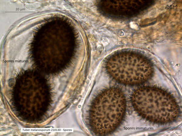 Use with permission Mature and immature spores in their asci.