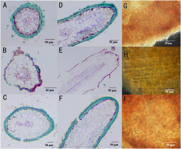 Comparison of ectomycorrhizae mantles of Tuber indicum and Tuber melanosporum.