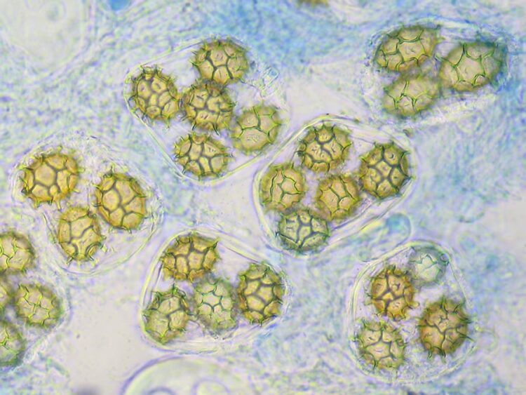 Microscopic view of Tuber aestivum ascus