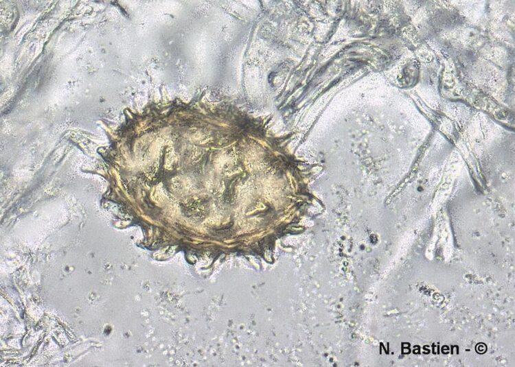An microscopic view of an ascospore from Tuber aestivum