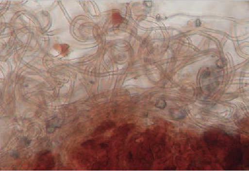 Microscopic view of Tuber aestivum cystidia
