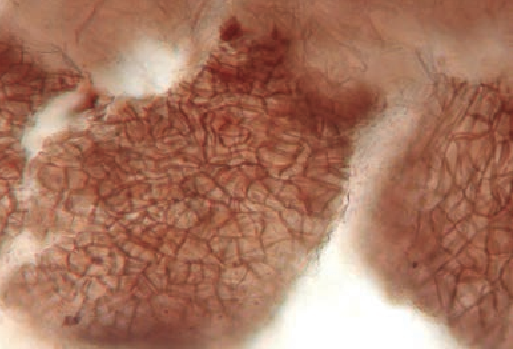 Microscopic view of the T. aestivum mantle