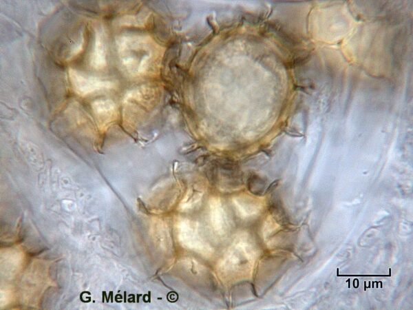Tuber-aestivumGM Close up on T. aestivum spore