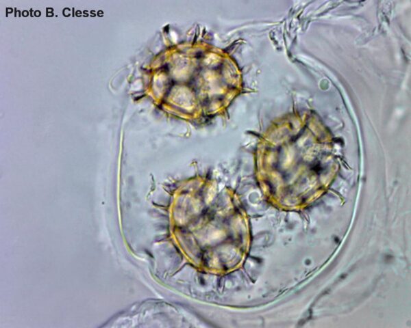 Tuber-uncinatumBC(4) T. aestivum ascus with 3 spores